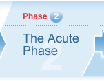 Acute Phase of Psychosis